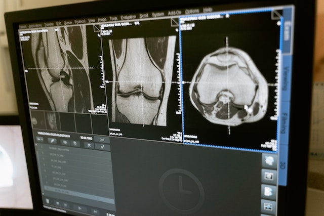 Mejora de la solicitud de resonancias magnéticas de rodilla en atención primaria mediante indicaciones adecuadas: un proyecto de mejora de la calidad.