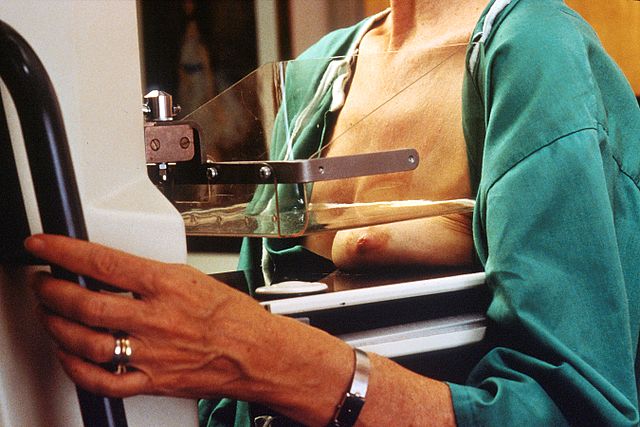 Comparativa de el dolor en els controls mamogràfics en pacients amb antecedents familiars de càncer de mama i pacients amb antecedents quirúrgics de càncer de mama.