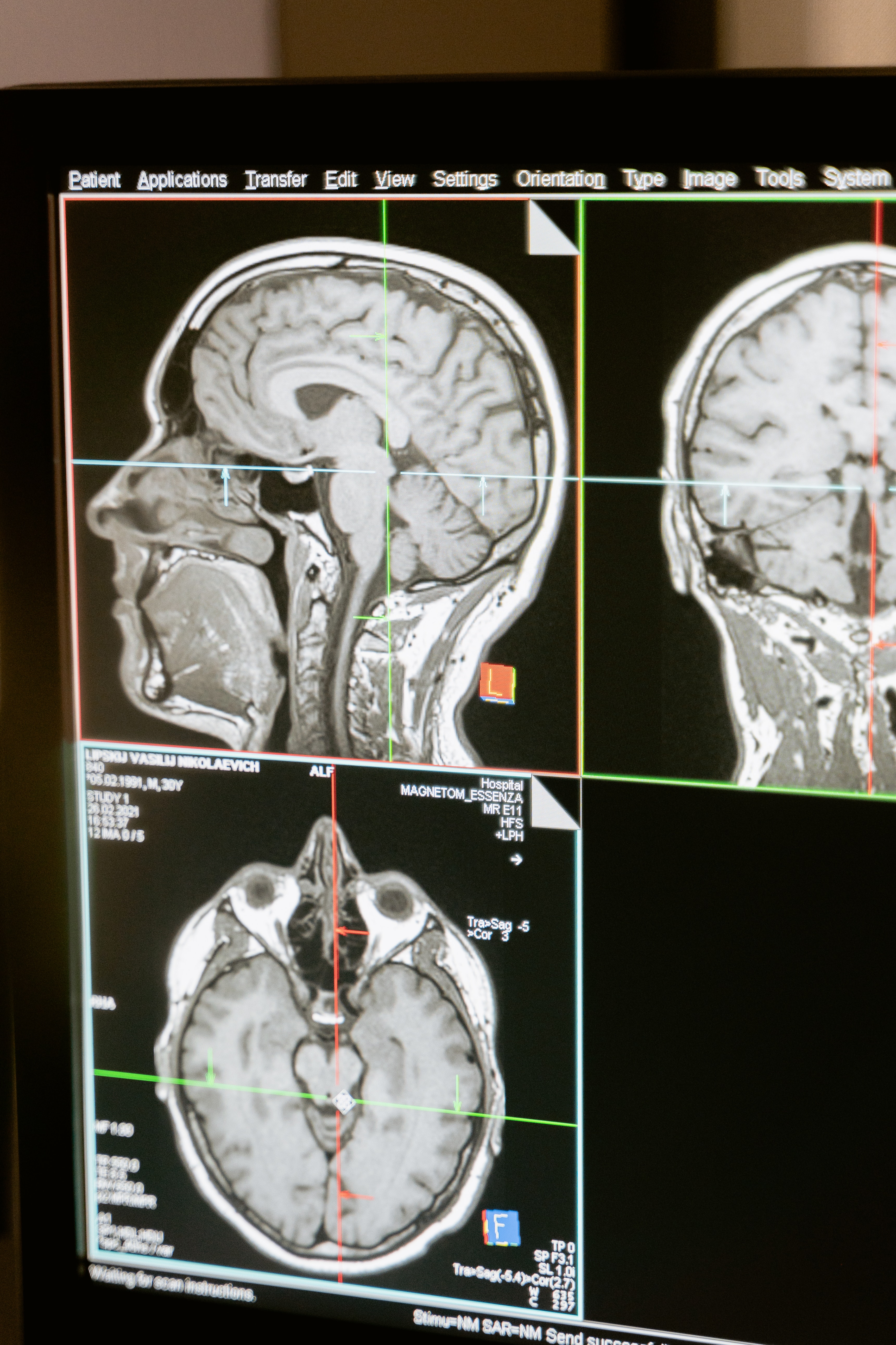 Ús de la revisió per parells en l'auditoria de qualitat en la RM i en les millores de les competències dels radiographers