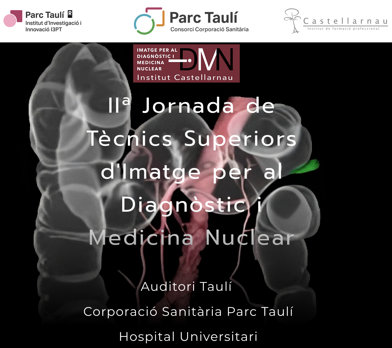 IIª Jornada de Técnicos Superiores de Imagen para el Diagnóstico y Medicina Nuclear.