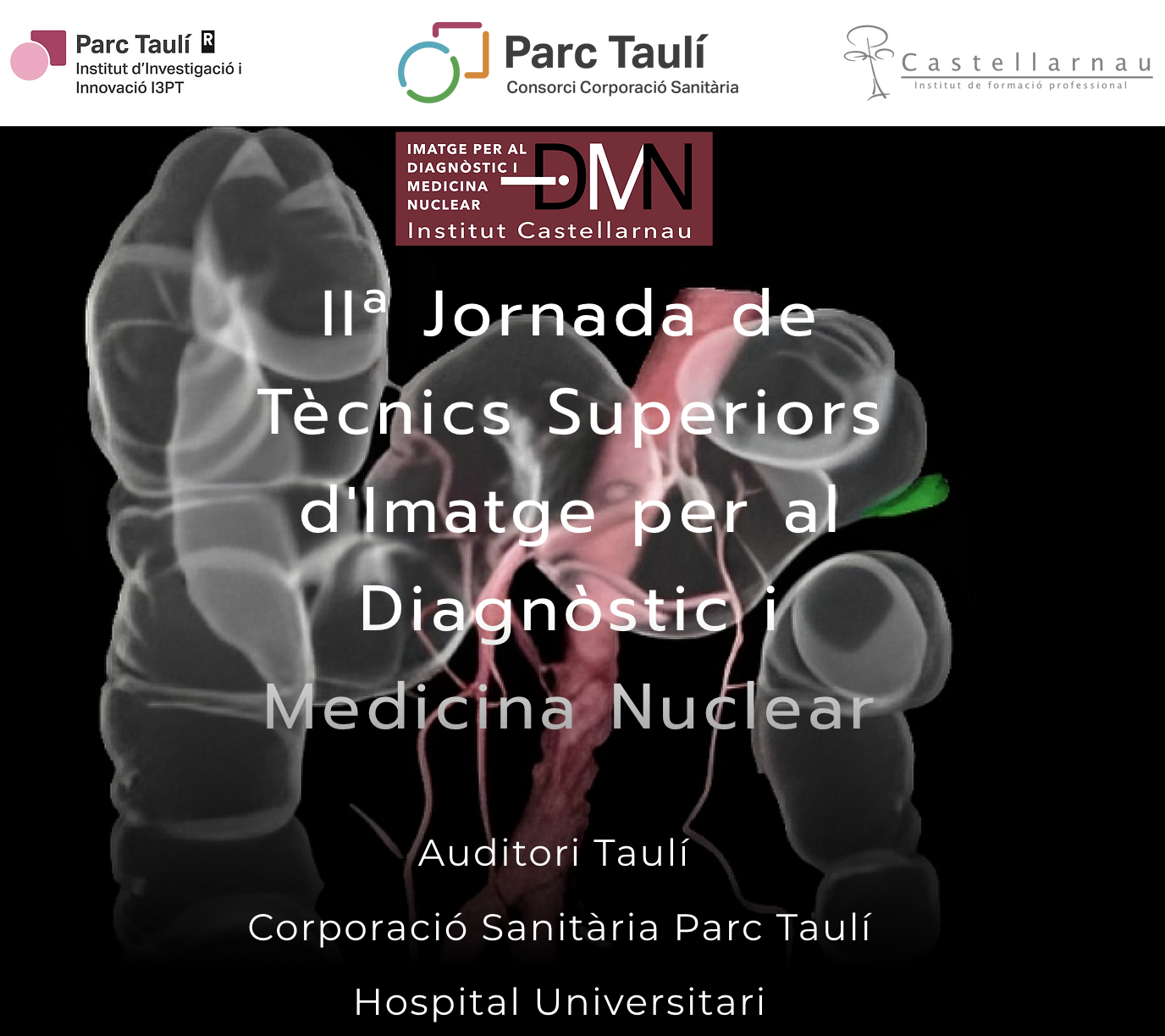 IIª Jornada de Tècnics Superiors d'Imatge per al Diagnòstic i Medicina Nuclear.