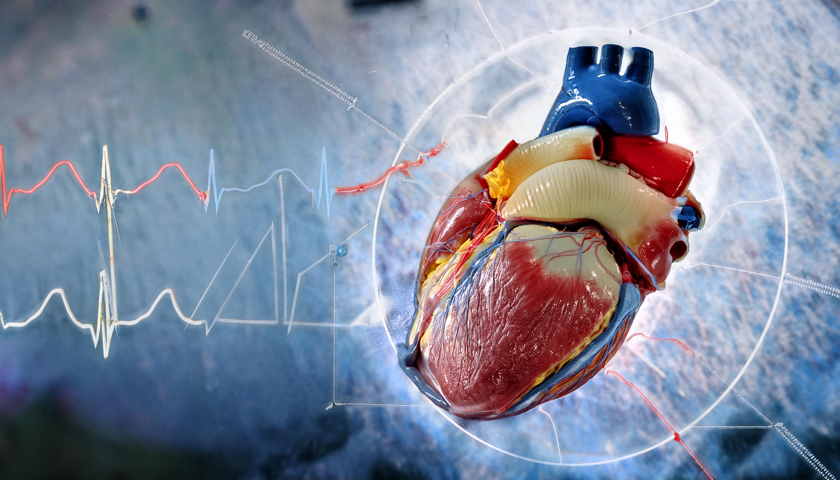 Remodelación del corazón derecho y resultados en pacientes con insuficiencia tricúspide.