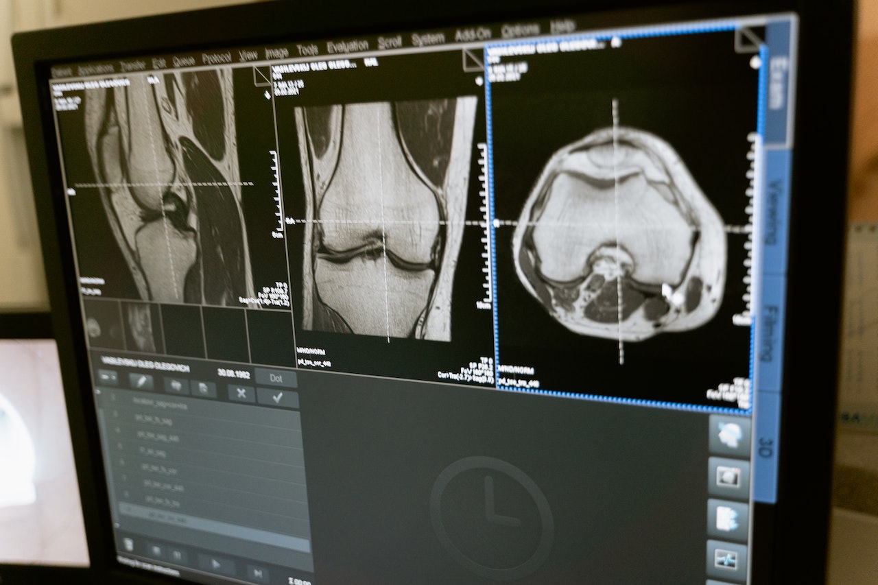 Tècniques de quantificació musculoesquelètica per Ressonància Magnètica: Una actualització.